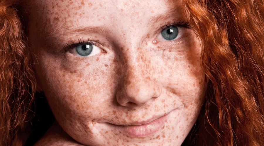 Image showing a beautiful red-headed girl with freckles