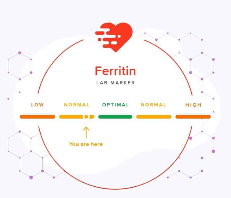 Negative Health Effects of Iron Deficiency & Associated Diseases -  SelfDecode Labs