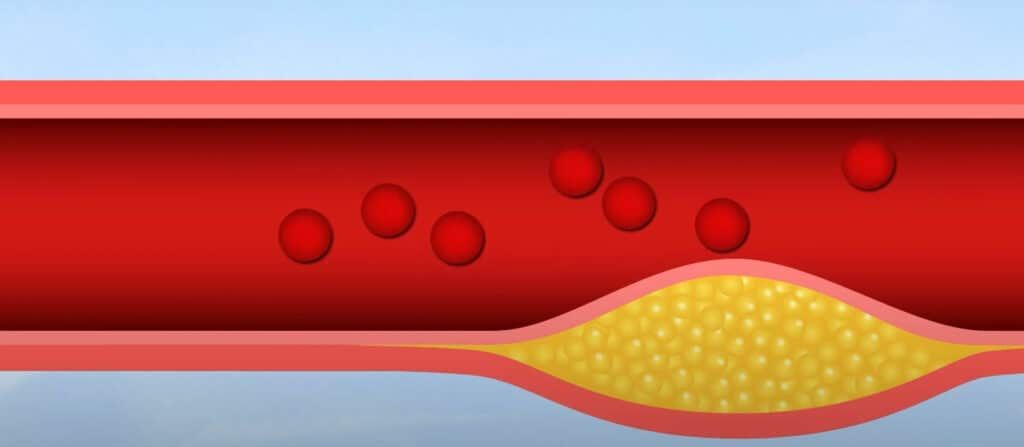 Vitamin B2 makes RBCs. Image shows RBCs inside a blood vessel