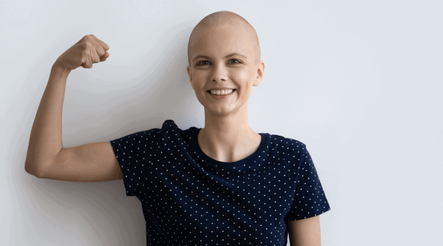 Permanent scalp alopecia related to breast cancer chemotherapy by  sequential fluorouracilepirubicincyclophosphamide FEC and docetaxel a  prospective study of 20 patients  Annals of Oncology