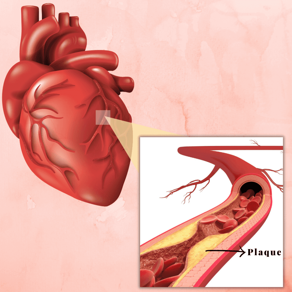 Sleep and atherosclerosis