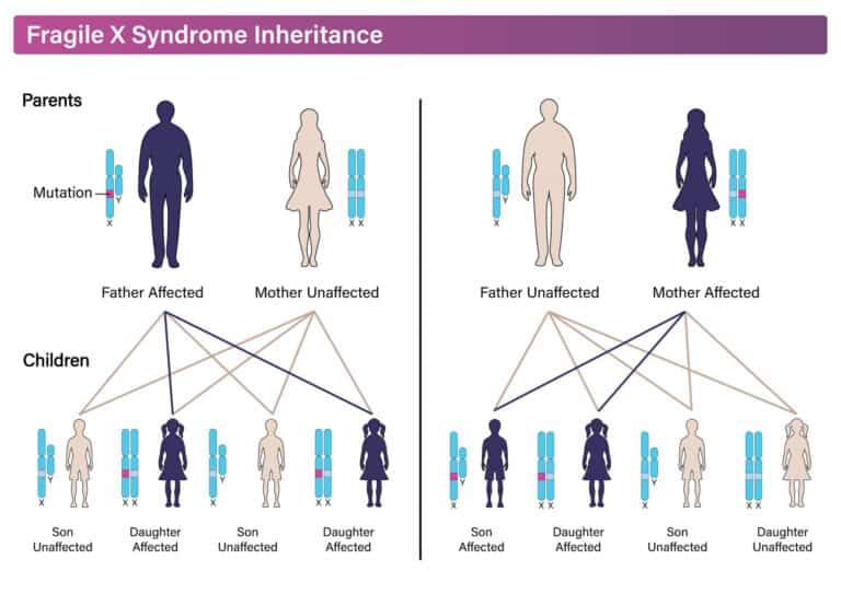 What Is The Most Common Cause Of Autism?