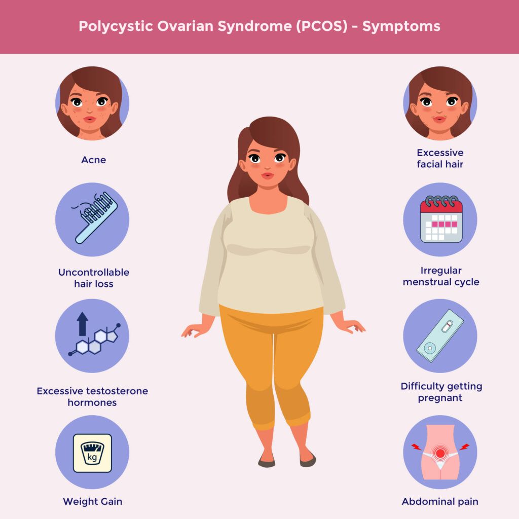 PCOS symptoms