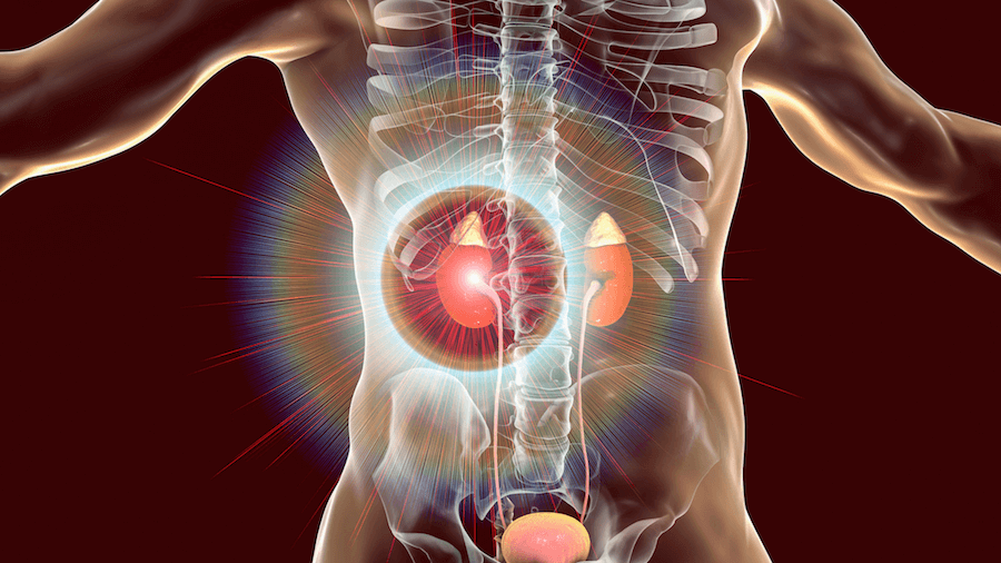 Is Addison S Disease Genetic Decode With Xcode   Is Addisons Disease Genetic 