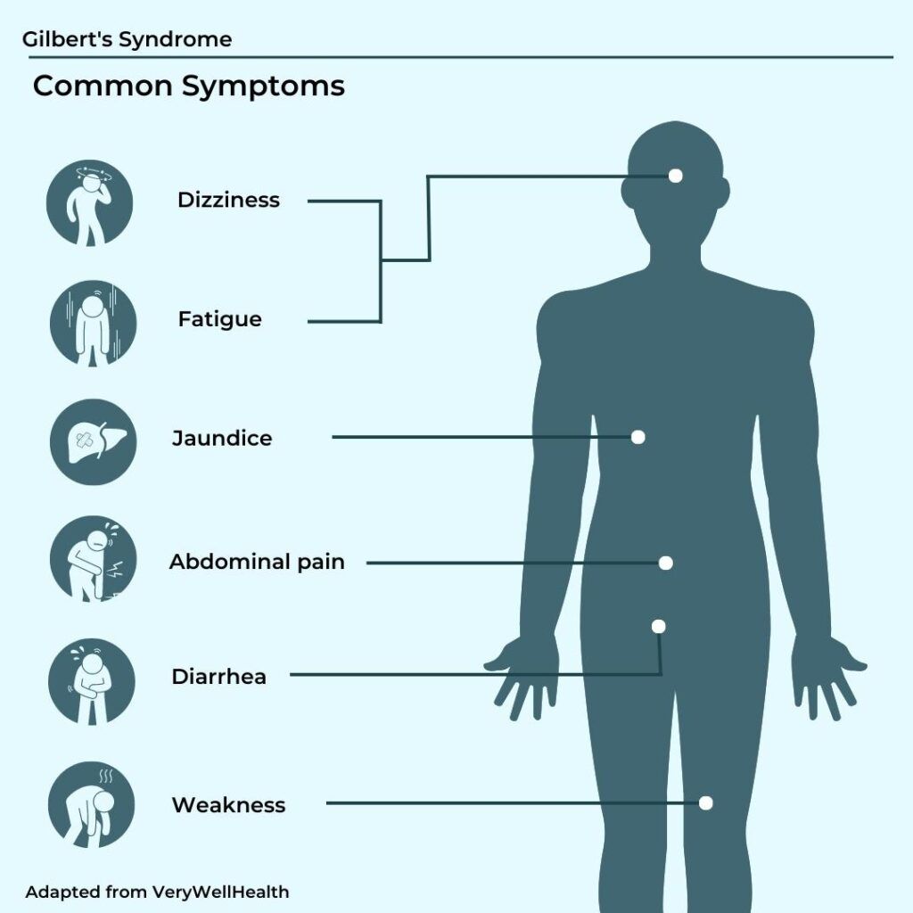 Is Gilbert’s Syndrome An Autoimmune Disease: Common symptoms of Gilbert's syndrome include tiredness. fatigue, nausea. weakness. abdominal discomfort, and jaundice