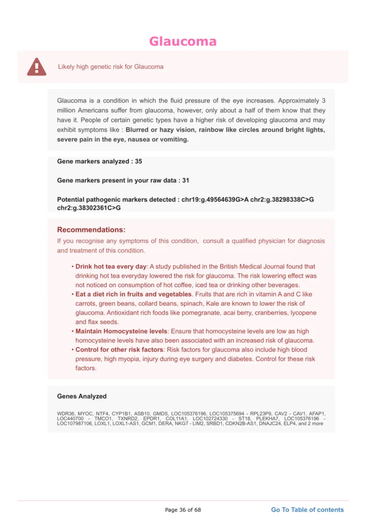 Corneal Thickness and Glaucoma: A sample genetic report for glaucoma revealing a high genetic risk. 