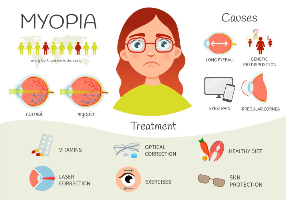 Infographic showing the genetics of myopia