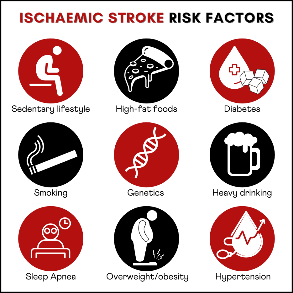 Are Strokes Hereditary? While genetics is an important risk factor for stroke, several lifestyle and environmental factors like sleep and diet patters, physical activity, and alcohol consumption also affect stroke risk.