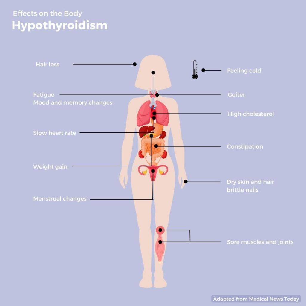 Private Thyroid Specialist London | Thyroid Clinic | Online Menopause Centre