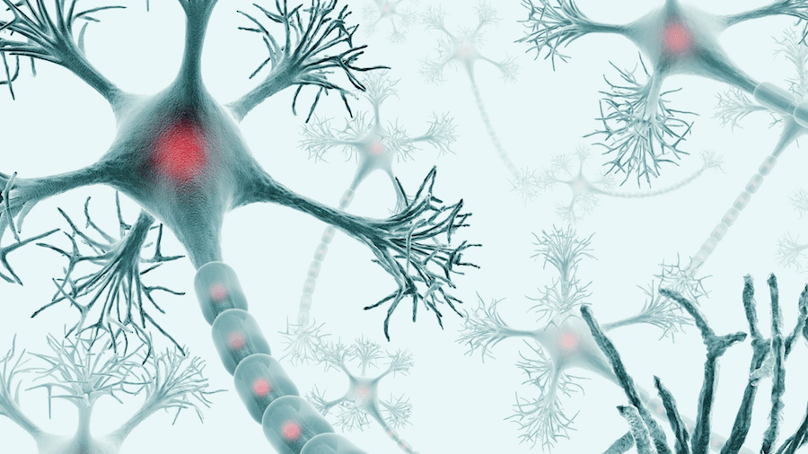 Image showing a human neuron