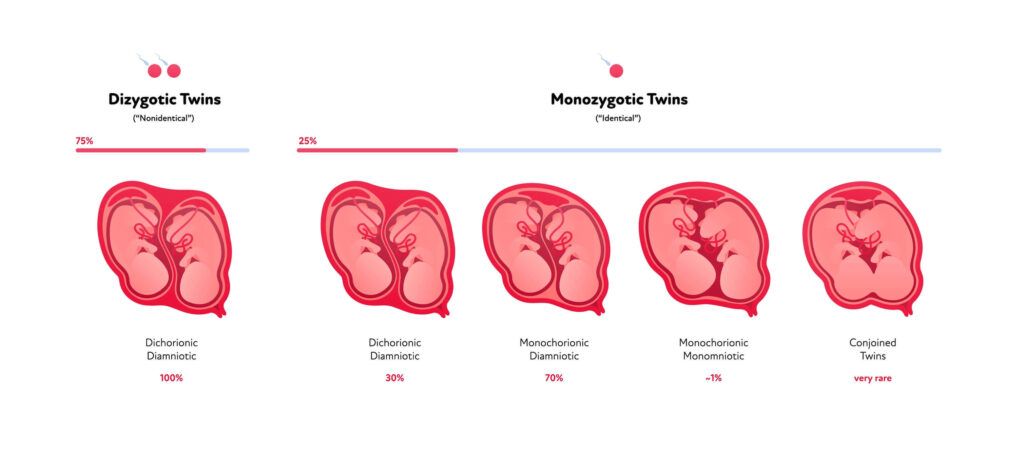 Image showing a diagram of different types of twins in the development stage