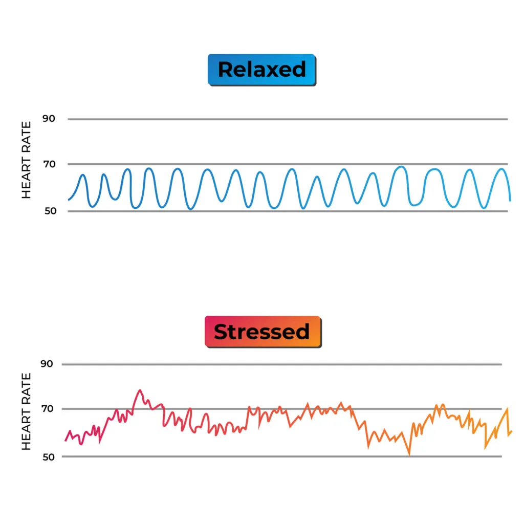 Image showing heart rate variability with stress