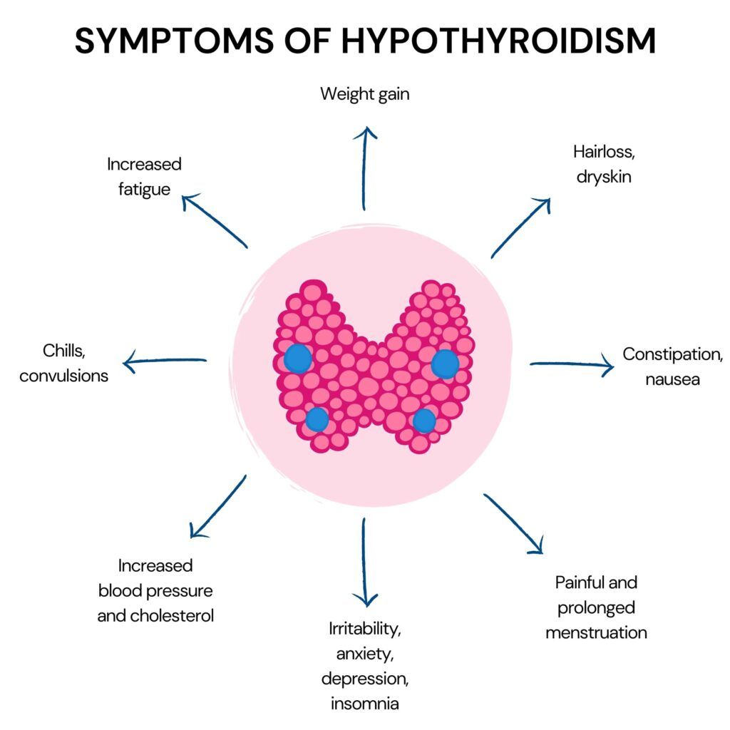 Infographic showing symptoms of hyperthyroidism