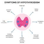 Intermittent Fasting And Hypothyroidism Xcode Life