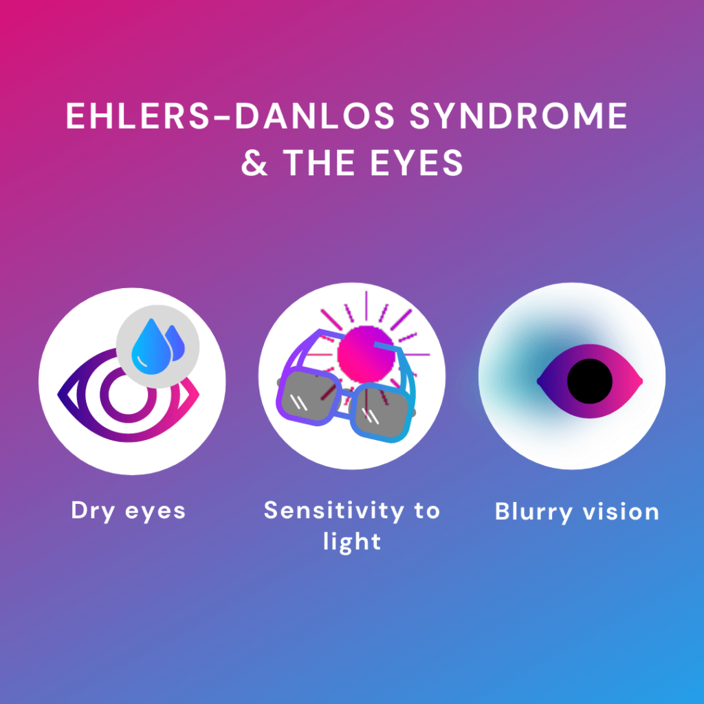 Effect of Ehlers Danlos syndrome on the eyes