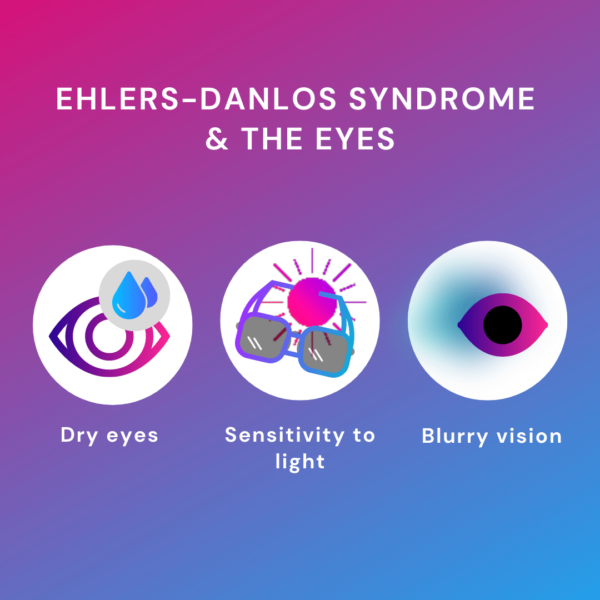 Ehlers Danlos Syndrome And The Eyes 4162