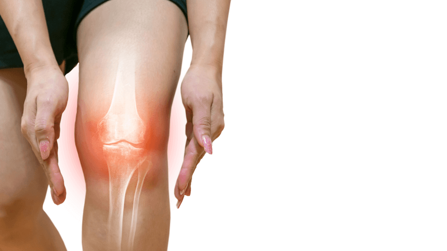 Image showing a painful joint flare-up