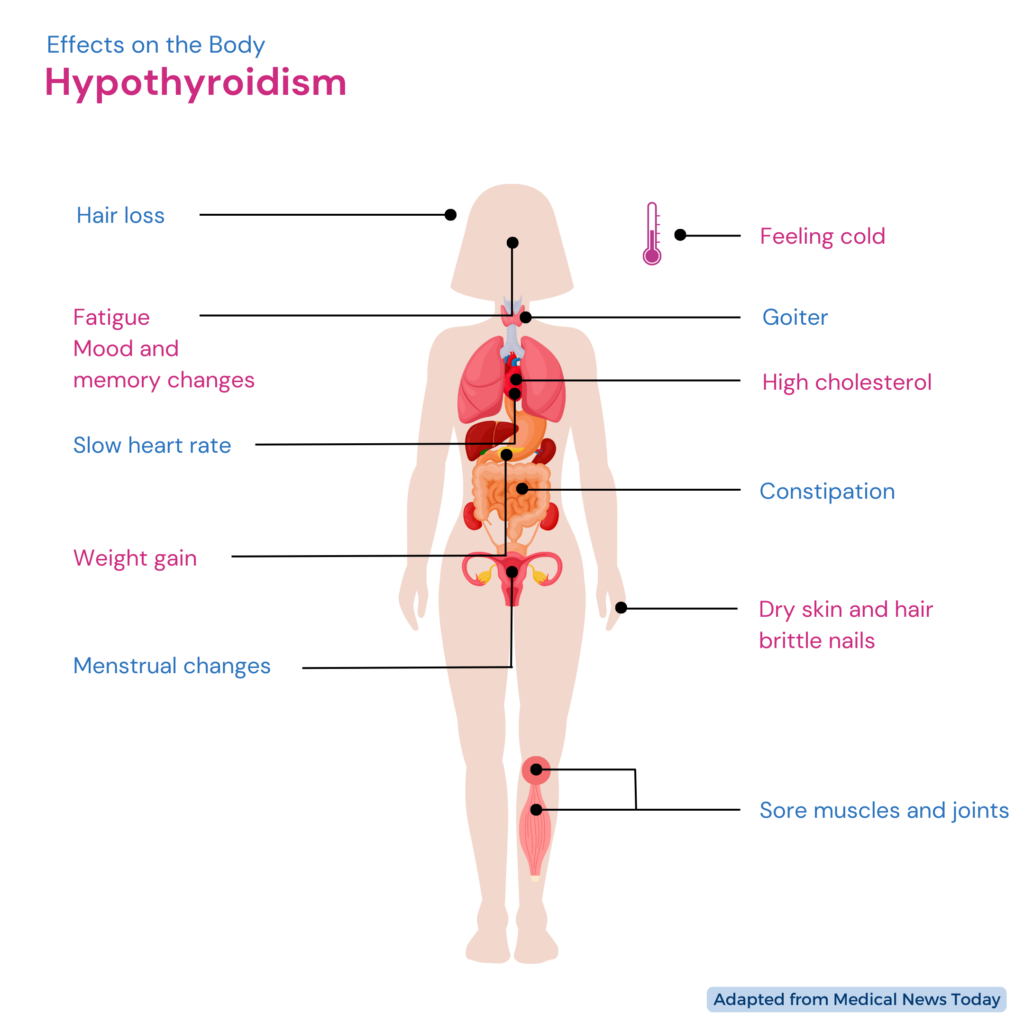 Infographic showing the effects of Hyperthyroidism