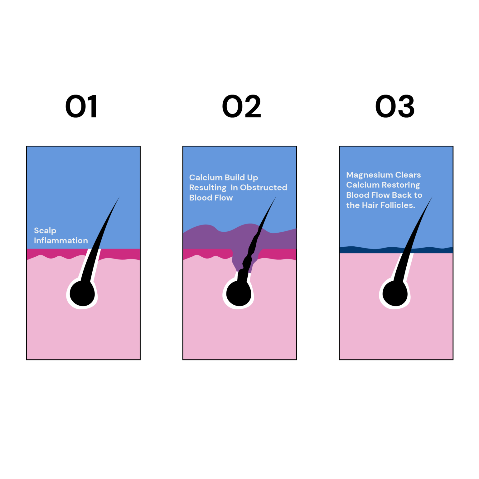 Can Magnesium Deficiency Cause Hair Loss? Xcode Life