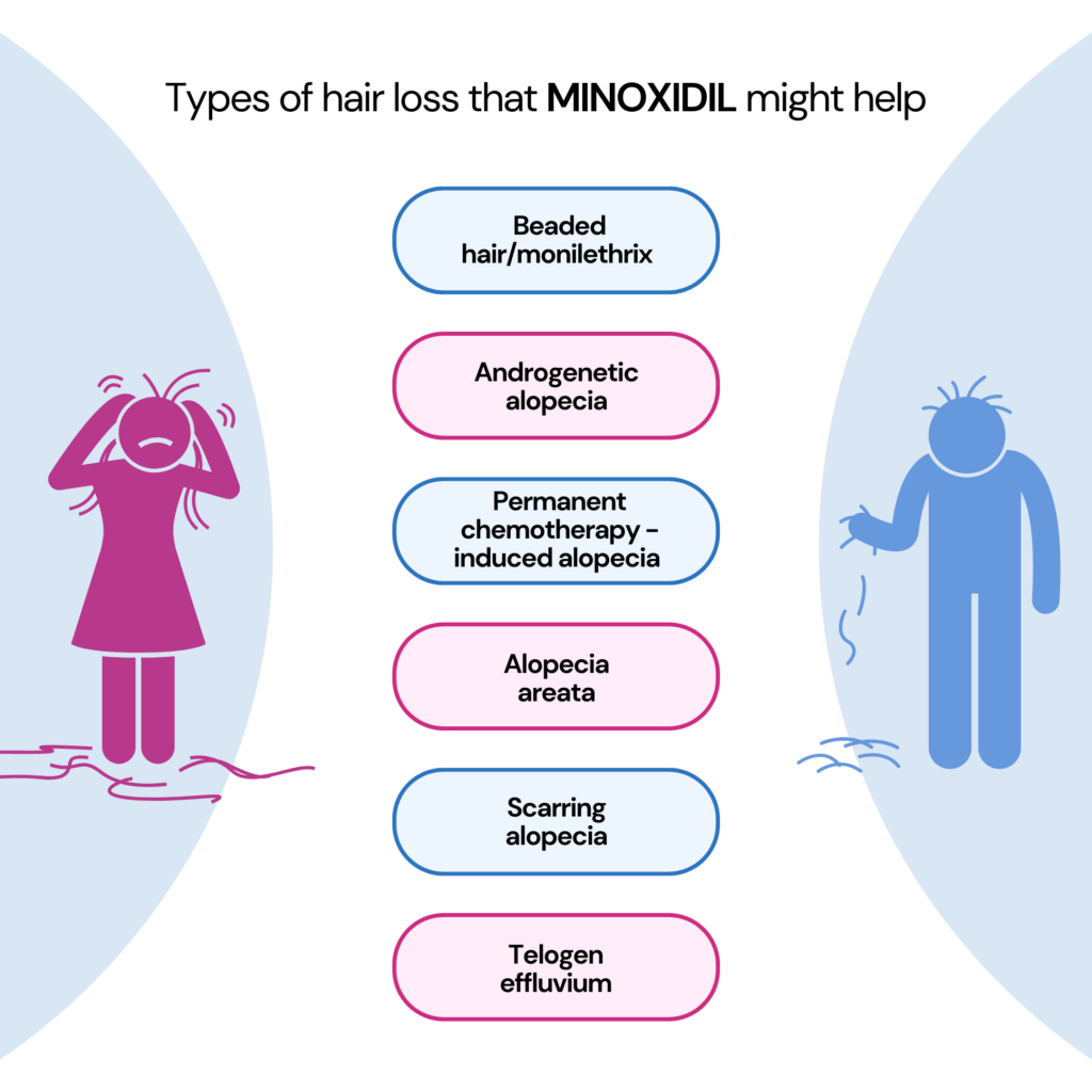 Oral minoxidil for hair loss: Infographic showing all the different types of hair loss that can be treated by minoxidil.