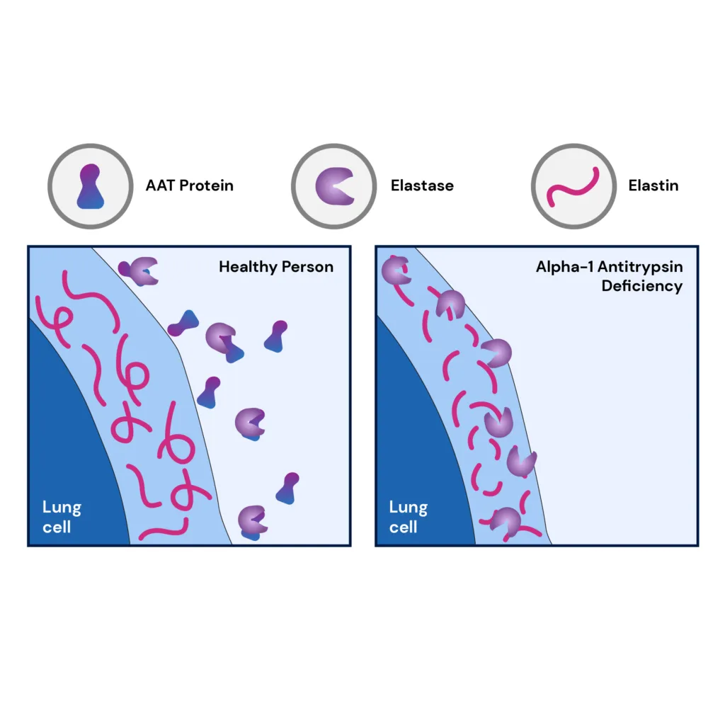 Image demonstrating genetic liver disease