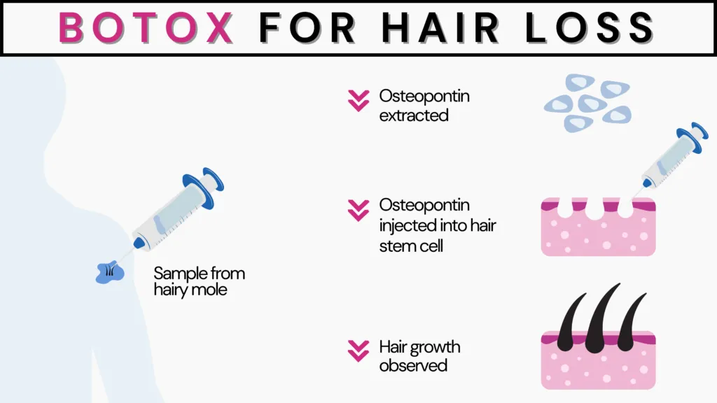 This pictograph demonstrates the experiment of taking the sample from a hairy mole of the human body where osteopontin is extracted. The extracted osteopontin was injected into the hair stem cells, and significant hair growth was observed.