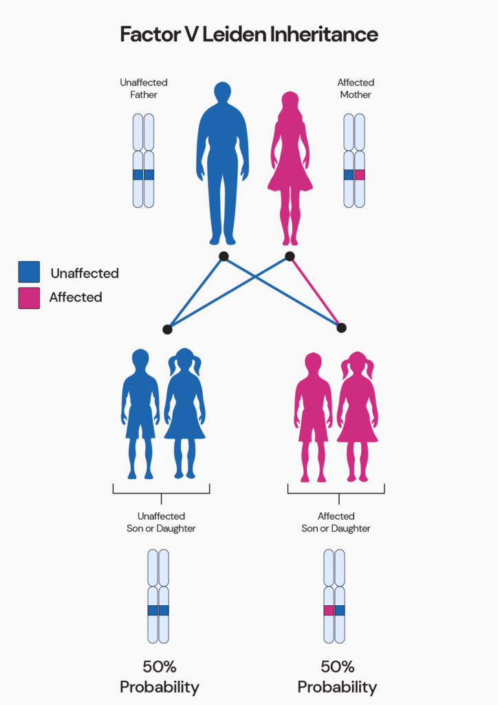 Factor V Leiden - genetic Inheritance Pattern