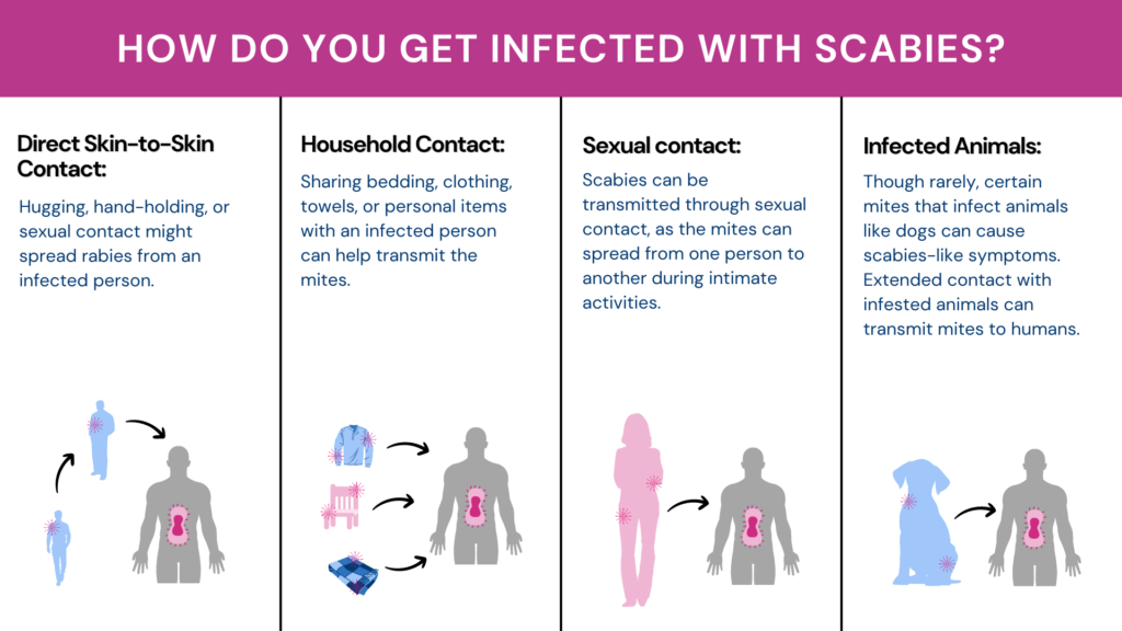 Is Scabies An STD? Infographic explains the possible modes of transmission of scabies. Divided into 4 columns, each column explains 1 route of transmission with a graphic and some text