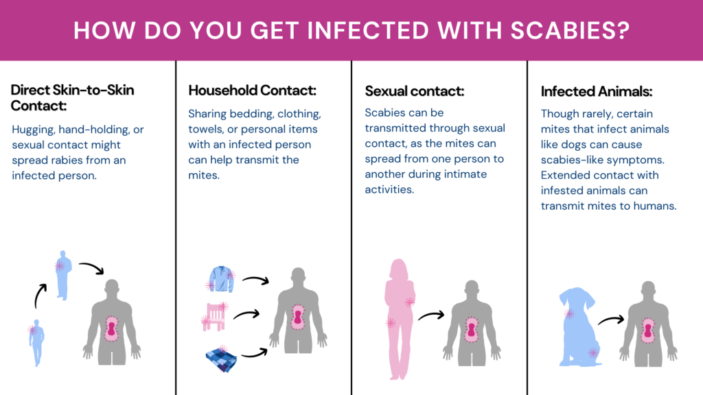 Is Scabies An Std Signs Transmission And Treatment