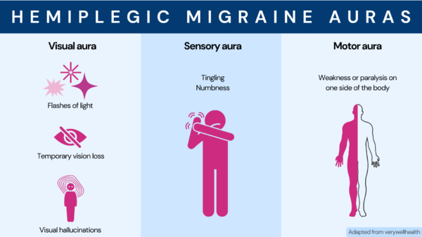 familial-hemiplegic-migraine-2023-study-identifies-2-new-genes