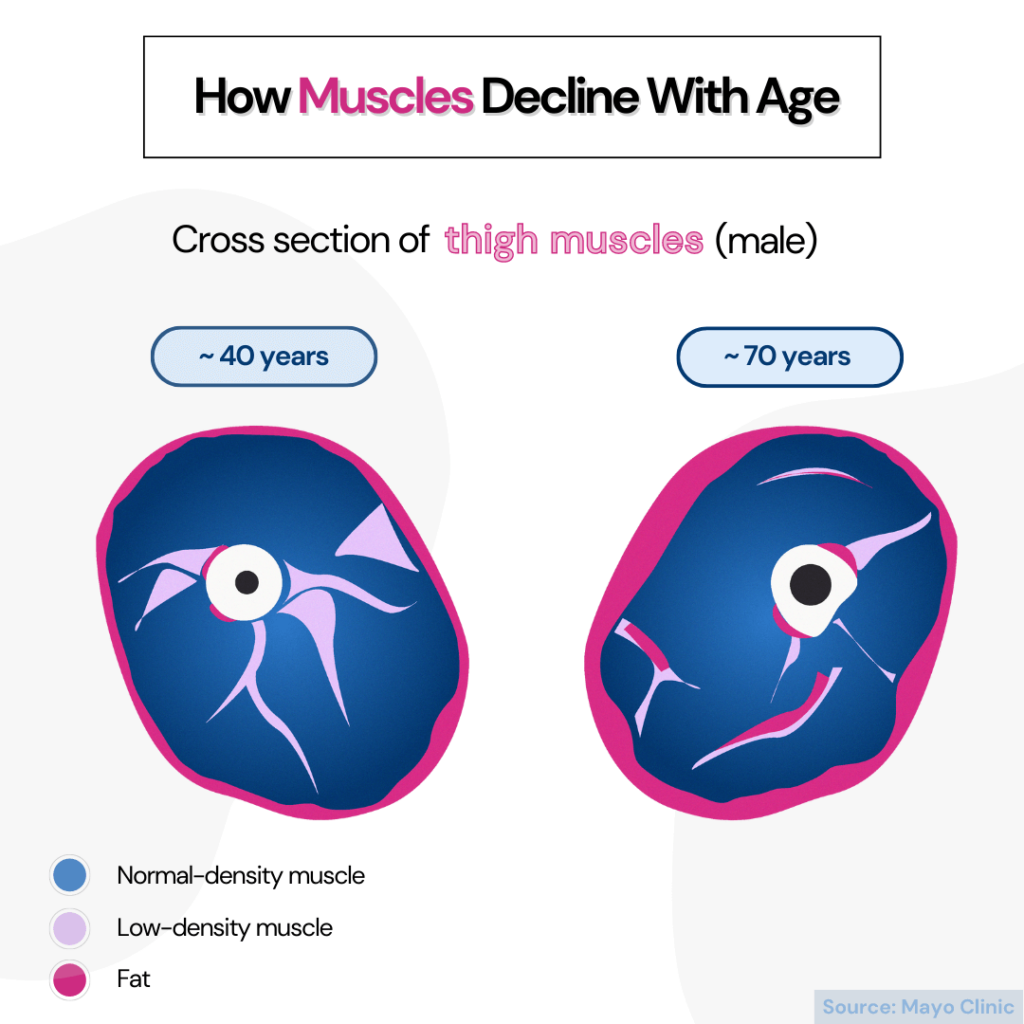 Comparison of thigh muscle tissue between a 40 year old and 70 year old man. 3 different colors are used to show the composition of two different types of muscle and fat.