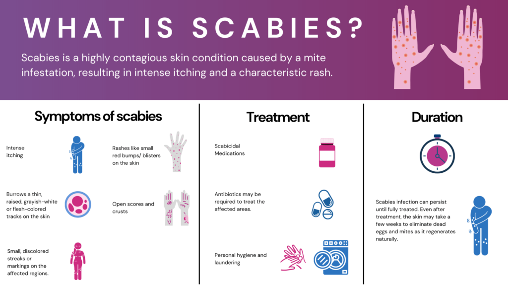infographic on scabies. divided into 3 columns separated by a black line.