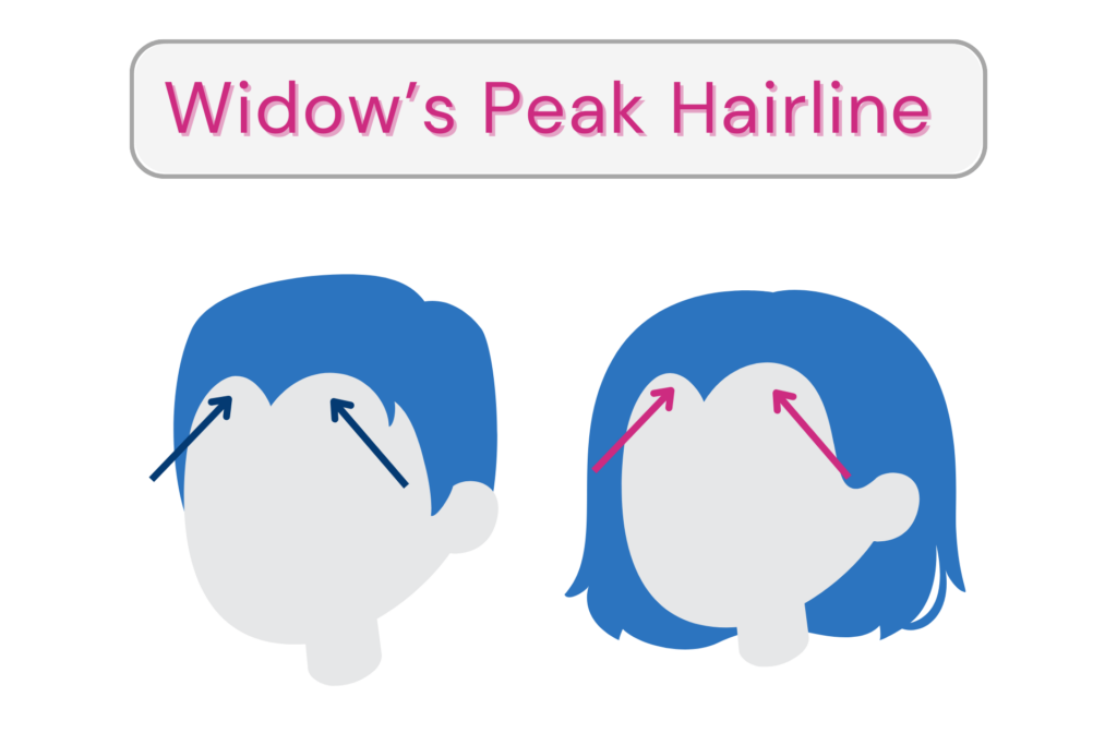 Widow's peak hairline resembles an inverted W or a pointy V