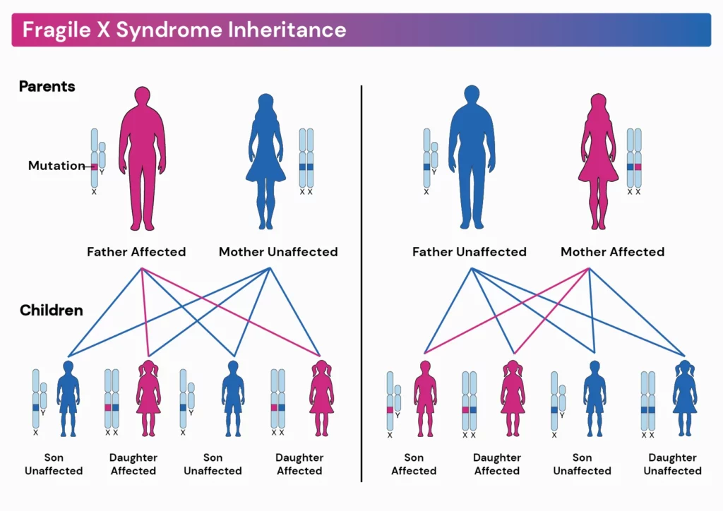 Inheritance of fragile x syndrome - when the father is affected, all the daughters will be affected. when the mother is affected, all children have a 50% chance of being affected.