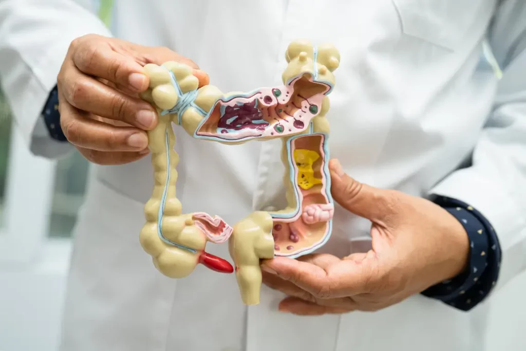 A doctor holding up a model of the gut